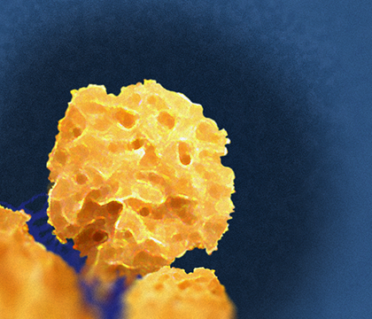 Grogan's virus microscopic view.